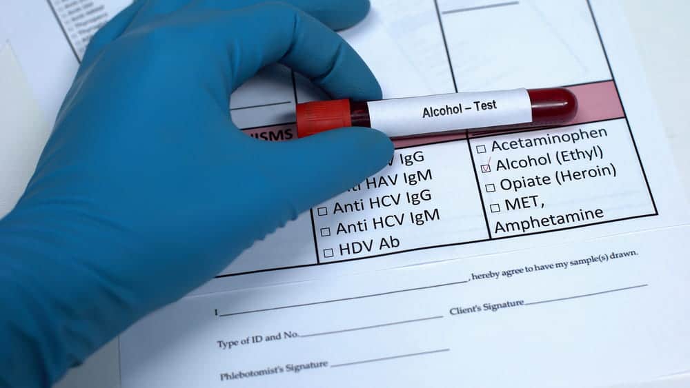 Image is of an alcohol test sample on a lab form, concept of chemical evidence in Ponte Vedra Beach DUI cases.